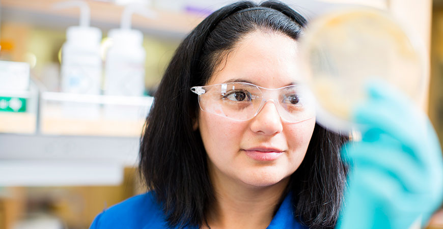 Professor Clarissa Nobile analyzes biofilm